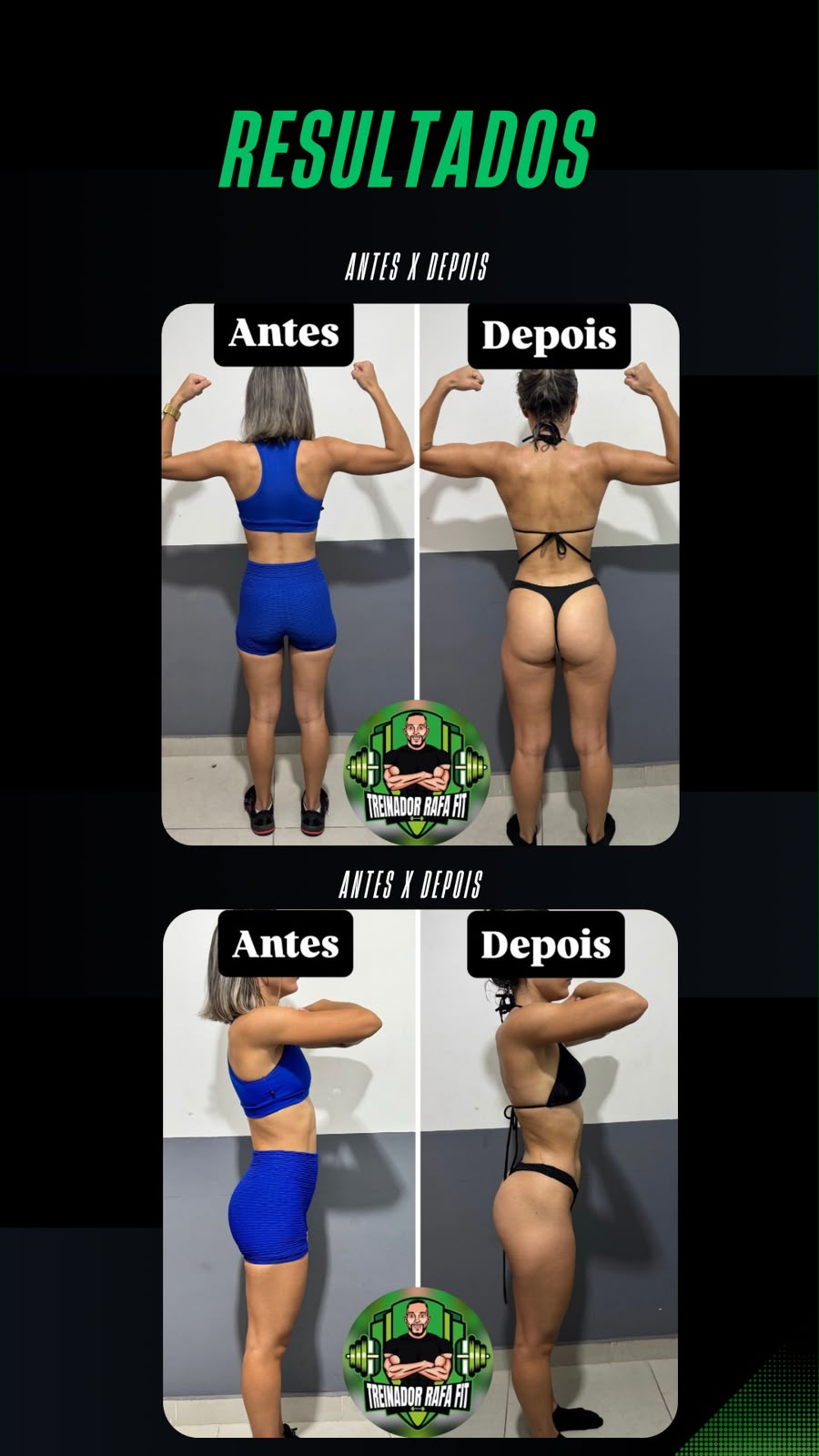 Resultado real 1 - Antes e depois de emagrecimento e definição física do aluno com acompanhamento Rafael Magno